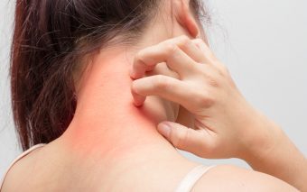 Îngrijirea pielii după un tratament cu laser: 3 sfaturi dermatologice esențiale