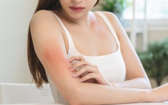 Băile sărate – aliatul natural împotriva problemelor dermatologice