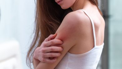 Psoriazisul, boala care începe cu pielea și afectează întregul organism